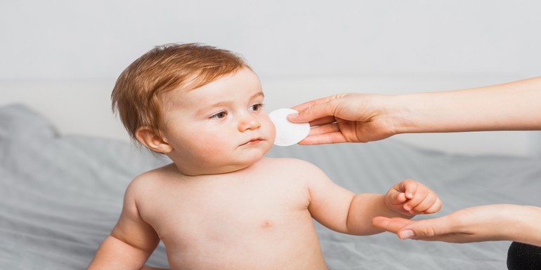 Cómo aliviar la dermatitis atópica infantil de forma natural